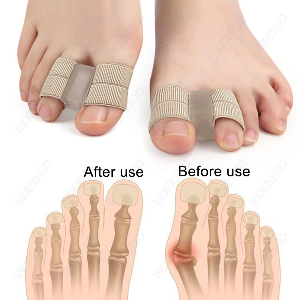 Bunion toe Corrector Orthotics - Women'S Shoes With Bunions 评论和价格
